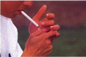「禁煙」とK-リゾレシチン