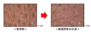 「K・リゾレシチン生ゼリー」摂取における皮膚シワ改善試験結果