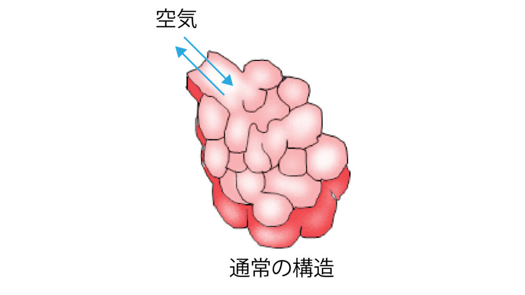 通常の肺胞の構造