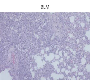 BLM